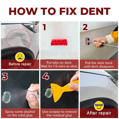 Dent Remover Tool Kit